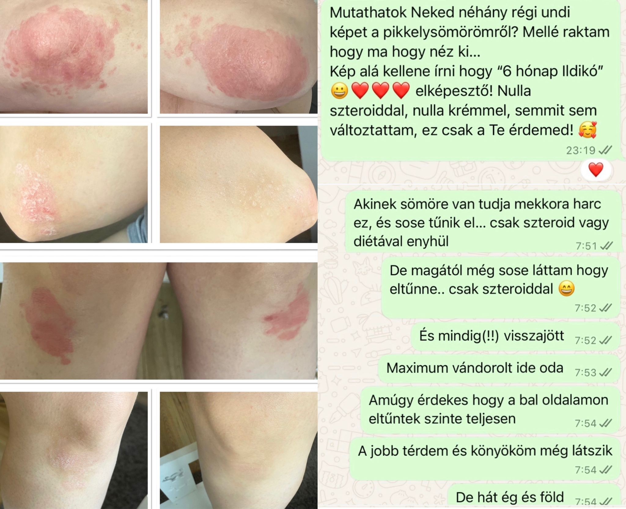 A gyógyulás energiái